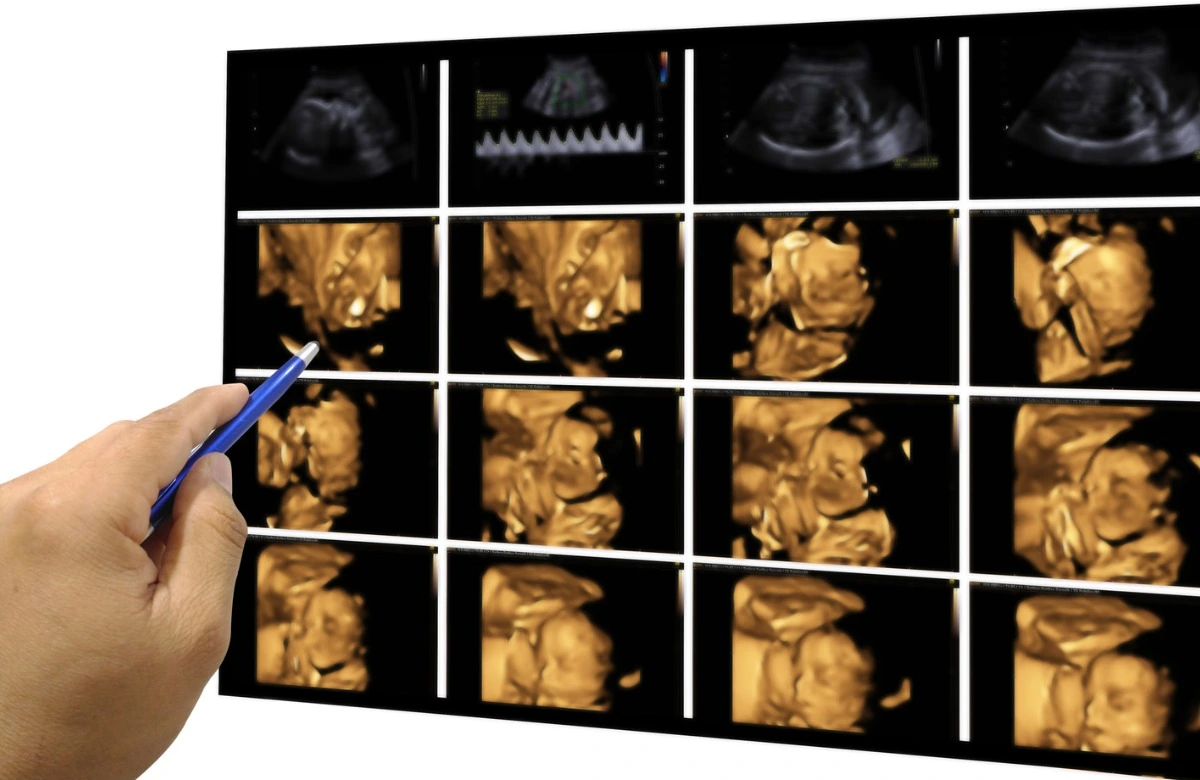 When Is Intervention on a Baby in the Womb Necessary? How Are Fetal Interventions Performed?