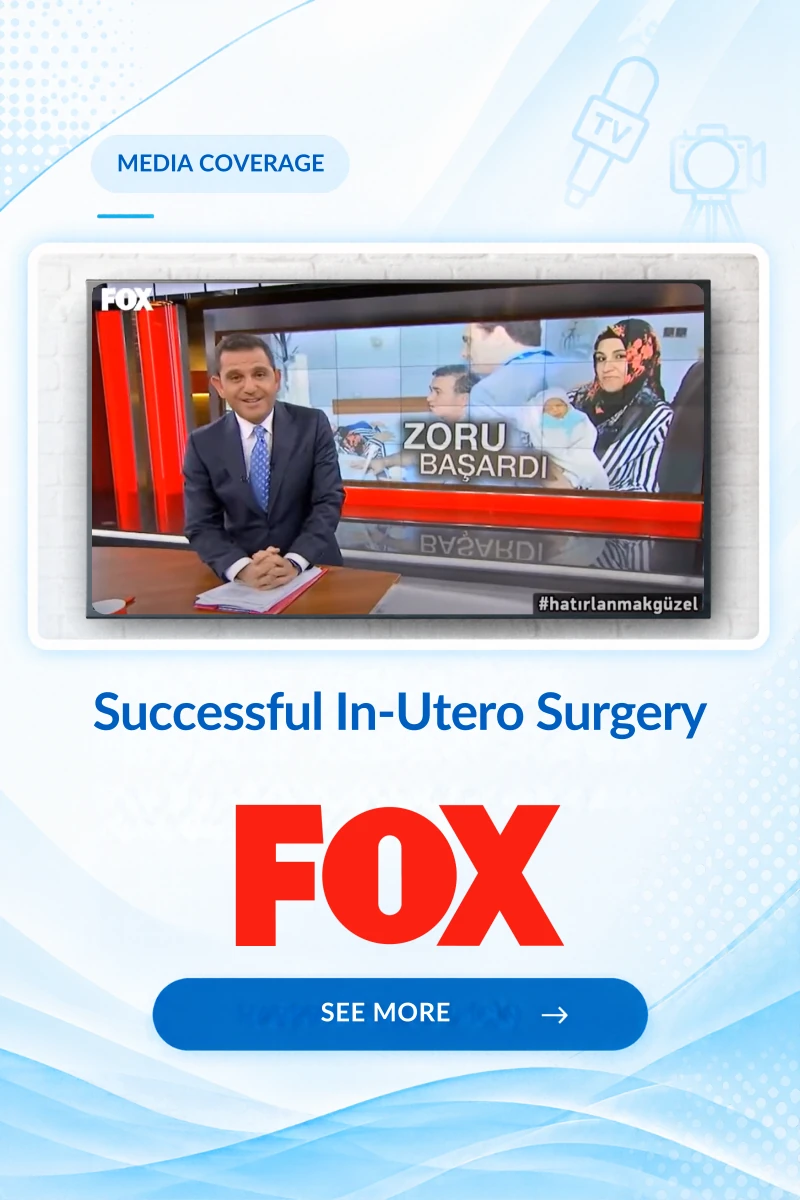 FOX News Mobil