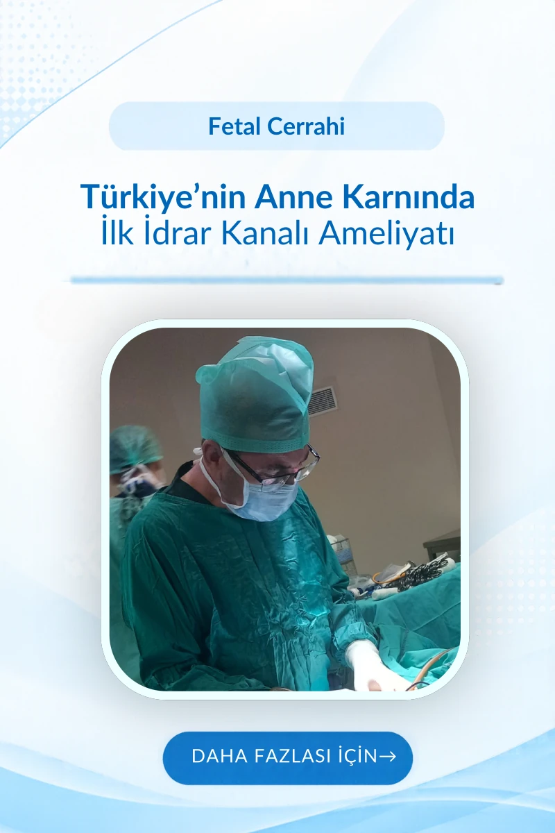 Fetal Cerrahi Mobil