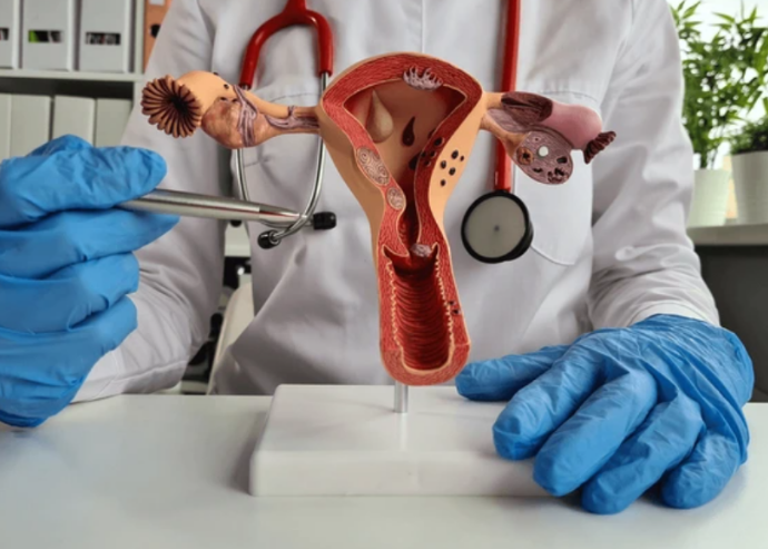 Endometrial Polip